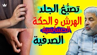 اختبار الألوان لعلاج الأمراض || تصبغات البشرة، الهرش و الحكة، الحساسية و الصدفية