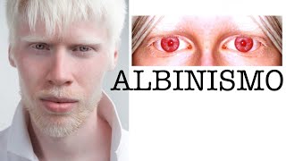 Albinismo: Rápido y Fácil