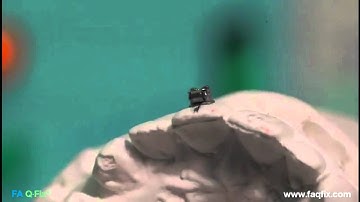 FAQFix - Indirect Technique - Step 8 - Remove the positioner.mp4