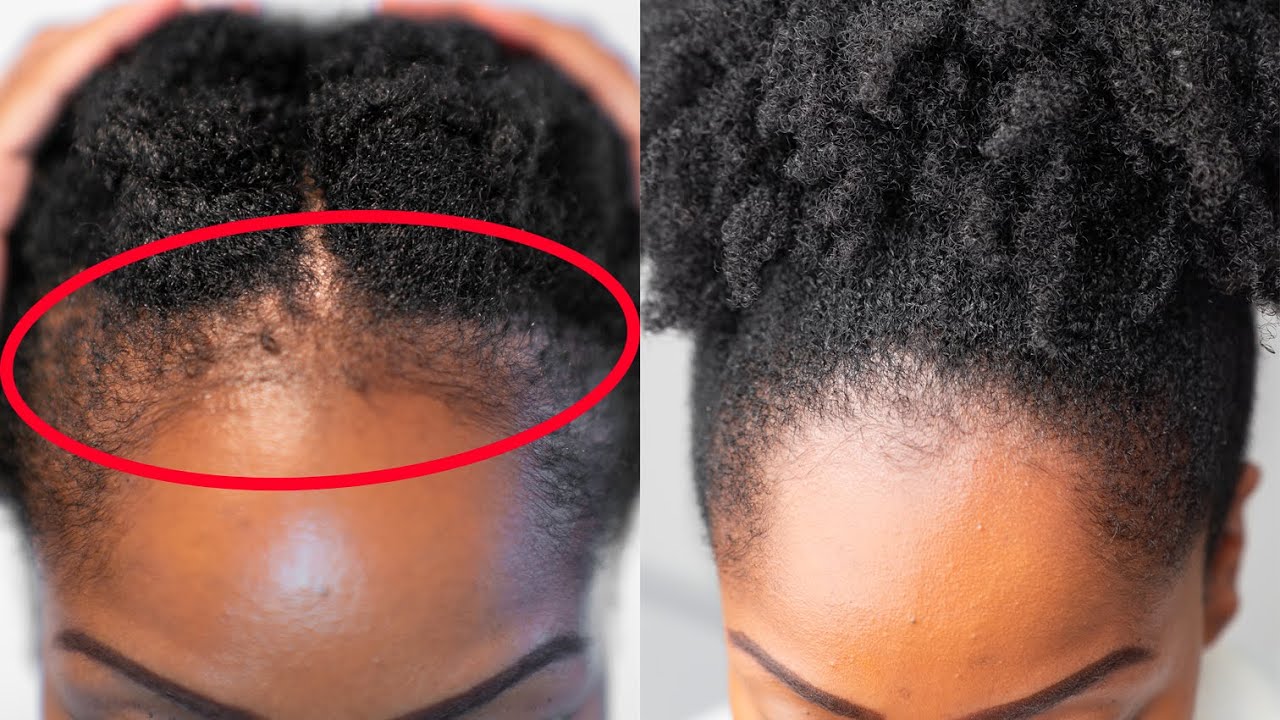 GROW Back Your EDGES FASTER with these 5 SIMPLE Tips! - YouTube