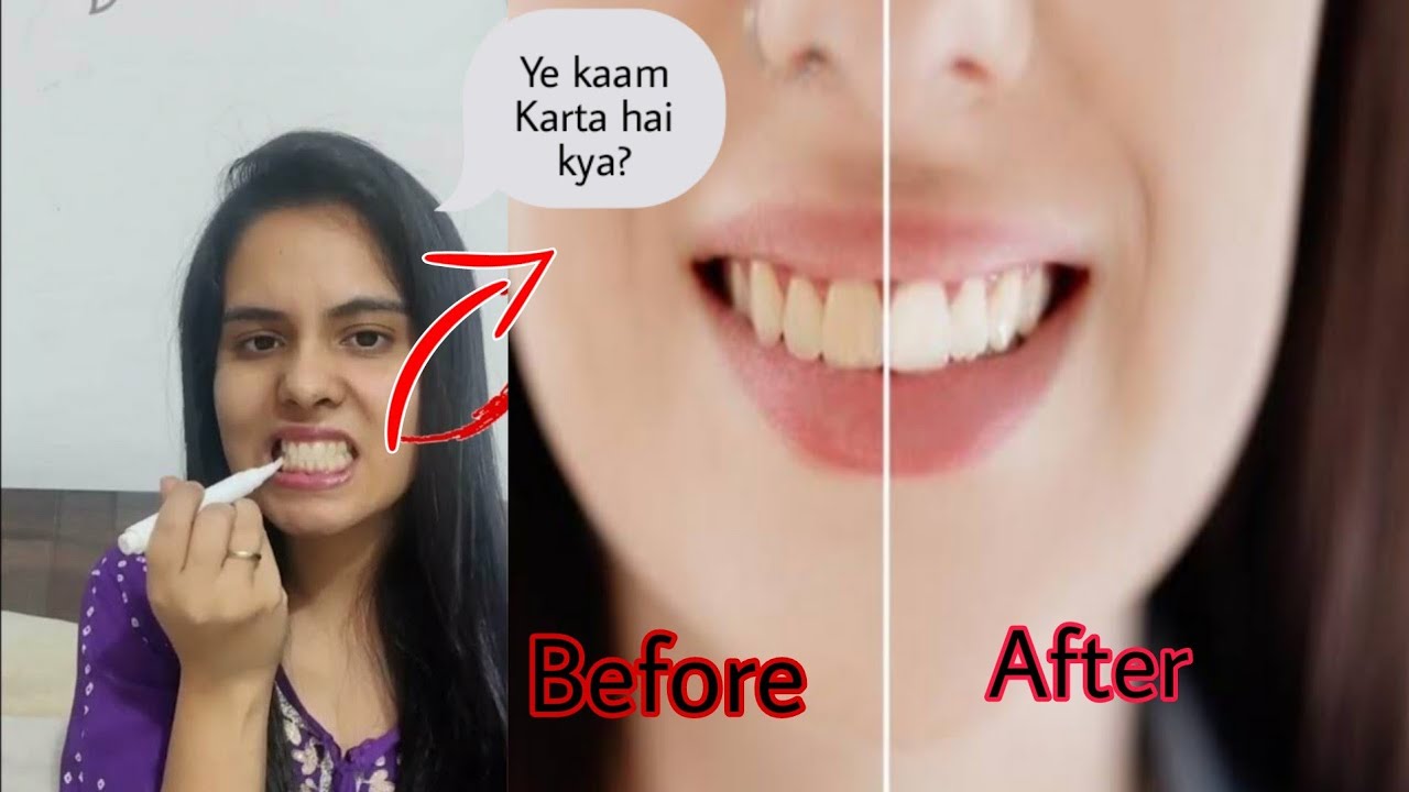 Testing Viral Protouch Teeth whitening Pen 🦷/ Protouch pearl white drop