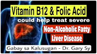 Vitamin B12 & Folic Acid for Fatty Liver - Dr. Gary Sy
