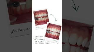 Peroxides Role in Teeth Whitening for Dental Professionals screenshot 1