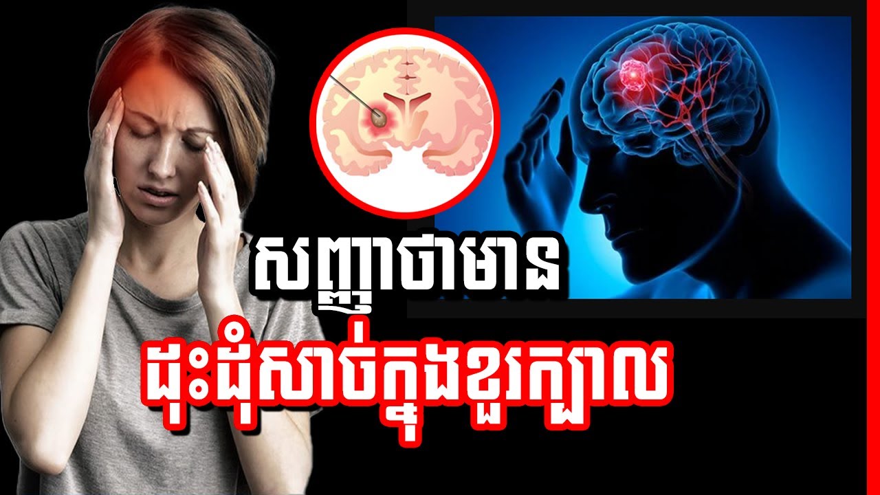 ជំងឺ​ដុះ​ដុំ​សាច់​ក្នុង​ខួរ​ក្បាល , brain tumour ,