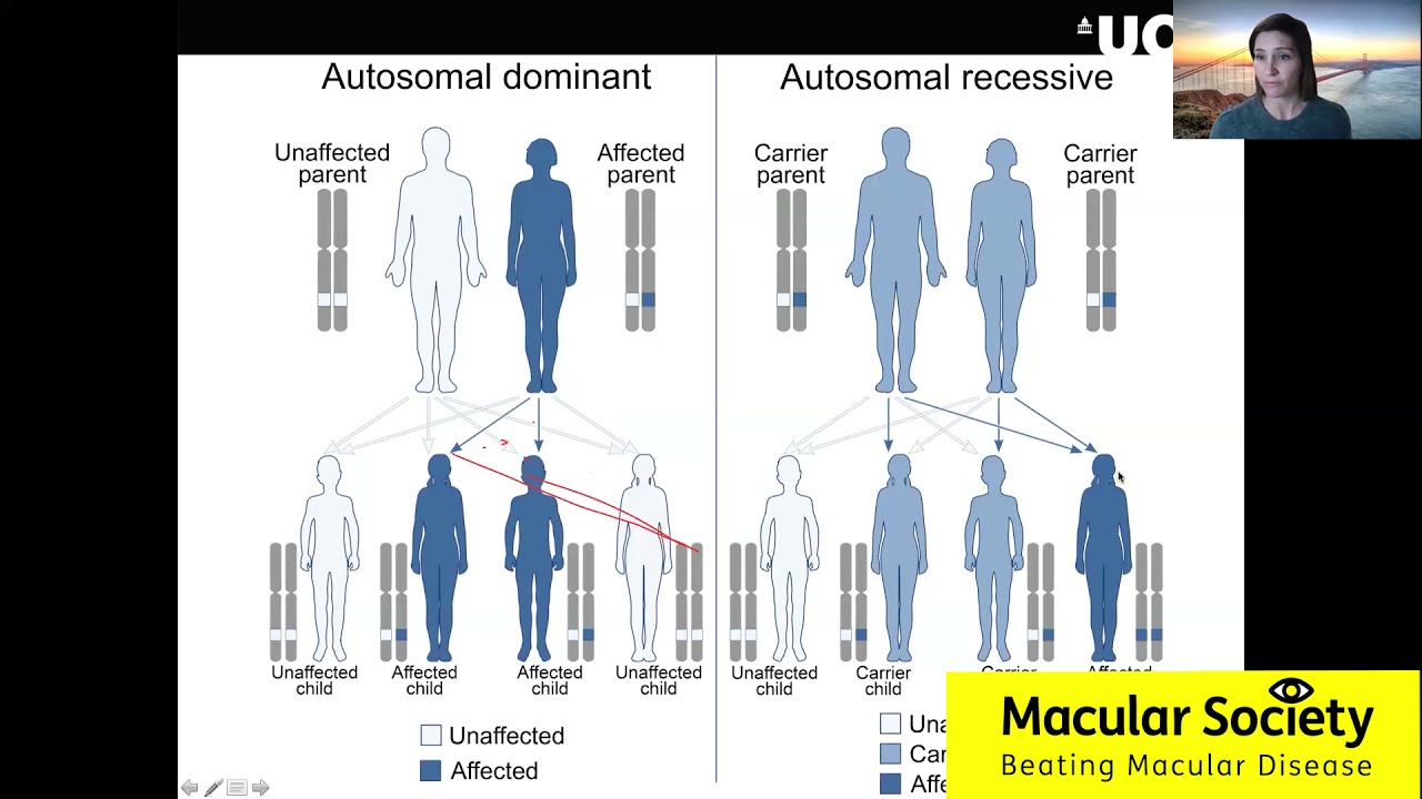 Potential treatments for Doyne honeycomb dystrophy.