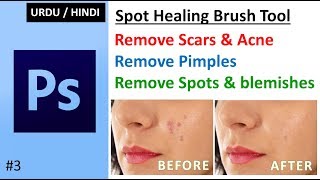 remove blemishes acne scars pimples spots in photoshop | spot healing brush tool tutorial in hindi screenshot 5