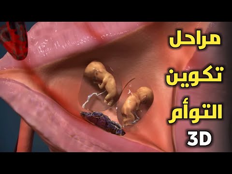 مراحل تكوين التوأم داخل الرحم من الاخصاب حتي تكوين التوأم المتشابه و الغير متشابه دروس طبية