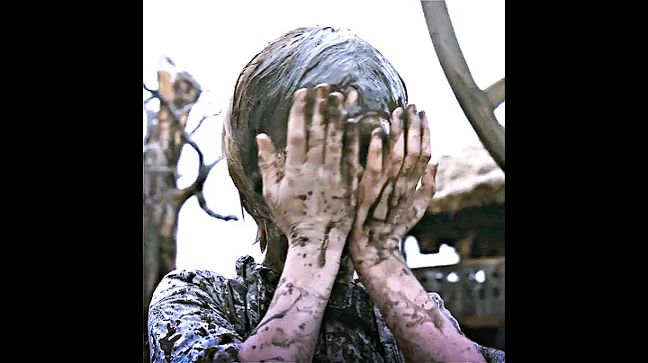 The boy lost his facial features #shorts