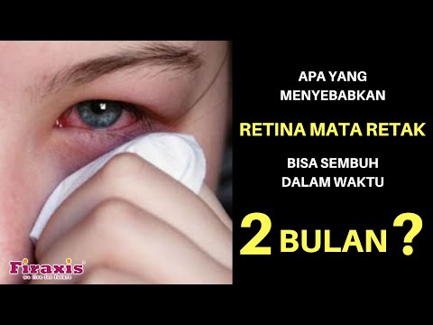 RETINA MATA RETAK SEMBUH TOTAL DENGAN BERRYTEIN ( 0823.3569.7770 ) RETINA MATA RETAK SEMBUH TOTAL DENGAN BERRYTEIN ( 0823.3569.7770 )
