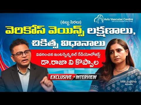 Who Is More Likely to Get Varicose Veins? | Dr. Rajah V Koppala | Avis Hospitals Jubilee Hills