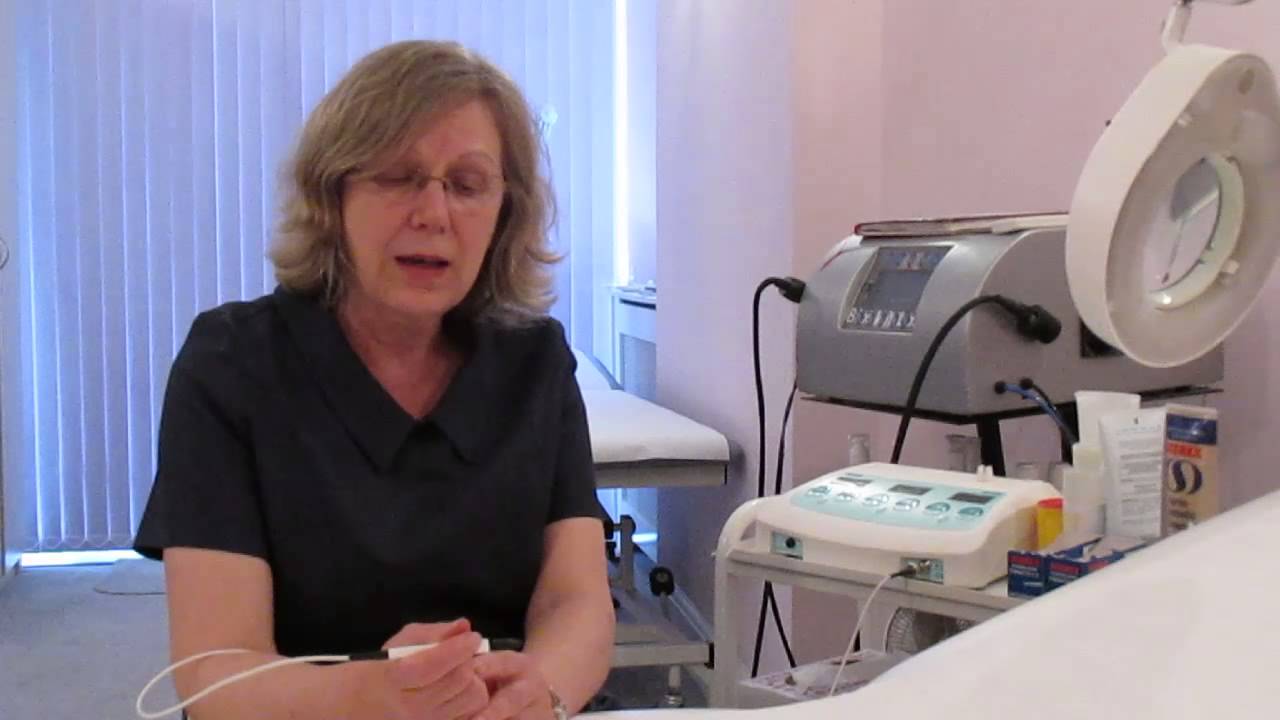 Wart & Verucca Removal using Advanced Electrolysis, London & Essex, 01708 727239