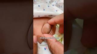 Pusat Baby Angin Pasang Umbilical Hernia Boleh Baik Sendiri  Drman Ttdi Story