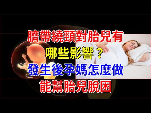 臍帶繞頸對胎兒有哪些影響？發生後孕媽怎麼做能幫胎兒脫困