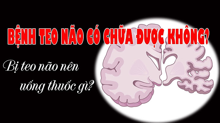 Nguyên nhân gây lõm não