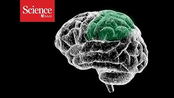 Moving robotic limbs with the power of imagination