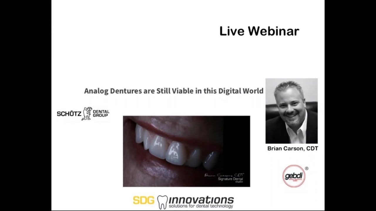 Analog Dentures are Still Viable in this Digital World - Live Webinar by Brian Carson