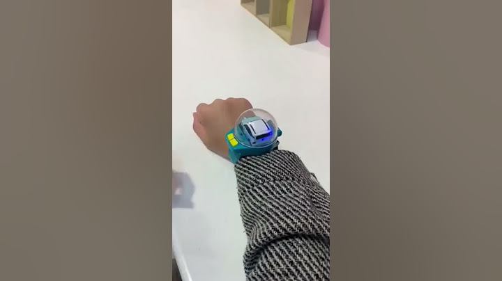 Watch Car 🚗 |  Mini Watch Remote Control Car