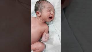 Newborn baby just after birth with definitely Oily skin #shorts