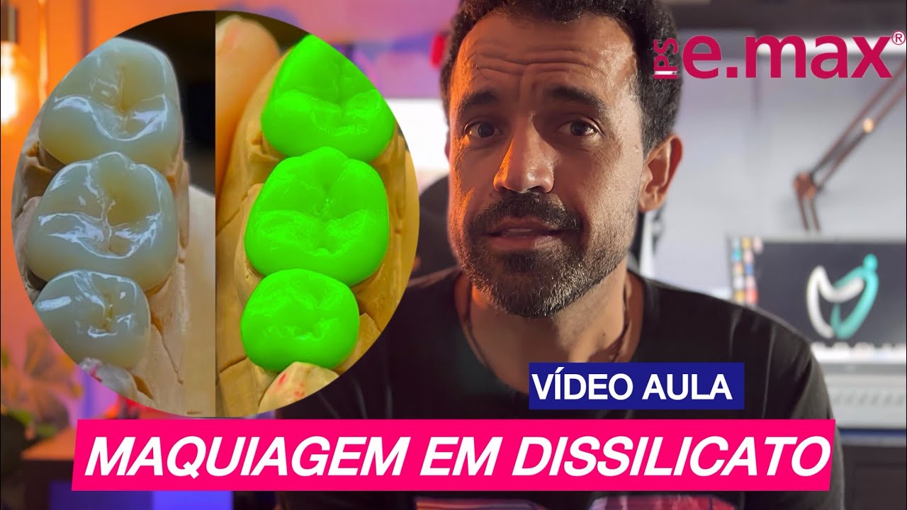 MAQUIAGEM/MAQUILHAGEM/MAKE EM DISSILICATO(E-max) passo a passo