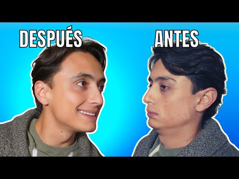 TRUCOS para una cara ATRACTIVA - Cómo ser más GUAPO