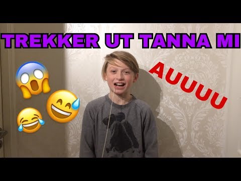 Video: Hvordan Trekke Ut En Babytenn