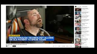 RE:Man speaks again in medical-first brain implant breakthrough