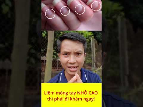 Video Xem ngay liềm móng tay của mình bạn nhé #shorts - youtube