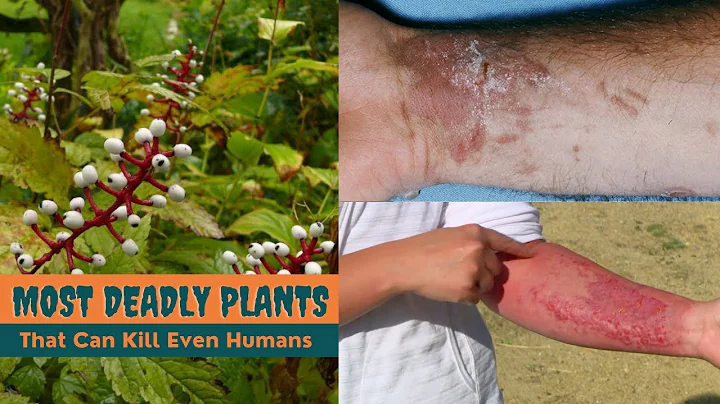 20 Most Deadly Plants That Can Kill Even Humans || Toxic Plants - DayDayNews