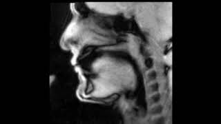 Douglas Yeo, trombone - MRI video 4 - slow double tongue