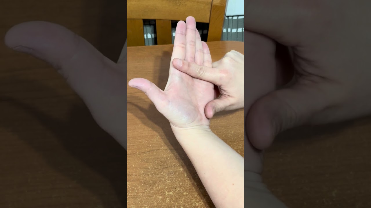 dactilol&oacute;gico en palma.