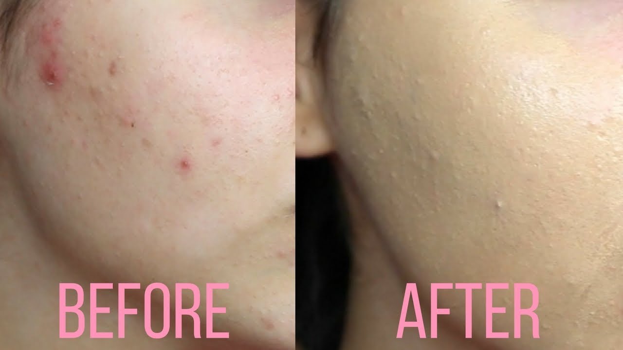 OMG 6$ FOUNDATION!  WET N WILD PHOTO FOCUS REVIEW