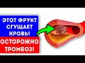 Осторожно, тромбы! 7 продуктов, которые превращают кровь в желе. Варикоз, тромбы, тромбофлебит