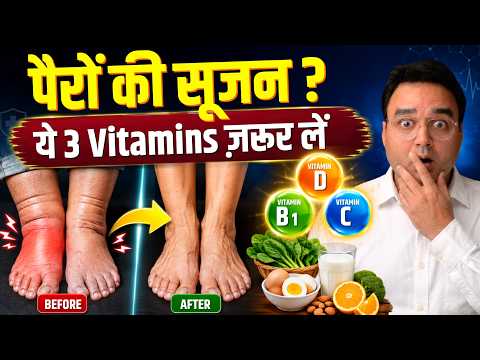 पैरों की सूजन और भारीपन कम करने वाले 3 ज़रूरी Vitamins | Dr Saleem Zaidi
