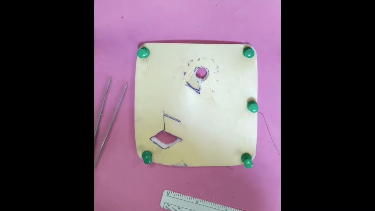 Modified Rhomboid Local Flap - 'Square Peg, Round Hole'