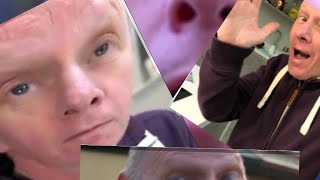 Bald Martin morgz