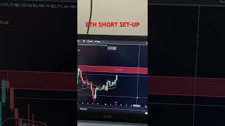 Eth Short Set-Update