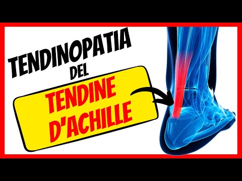 Tendinopatia achillea -  Ep. 3 Angolo del runner