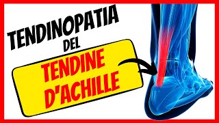 TENDINOPATIA ACHILLEA 🔺 Infiammazione tendine d'Achille: cos'è e come si cura