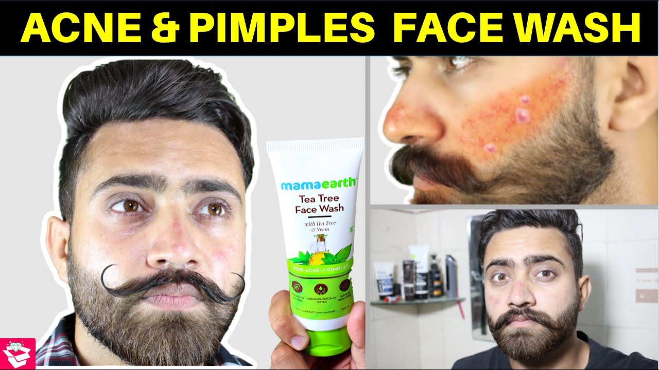Гель для умывания от акне и прыщей | Обзор средства для умывания с чайным деревом MAMAEARTH | Qua...