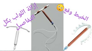 إزالة اللولب مؤلمة ونزيف ولا يوجد خيط، فما الحل؟ يوتيوب