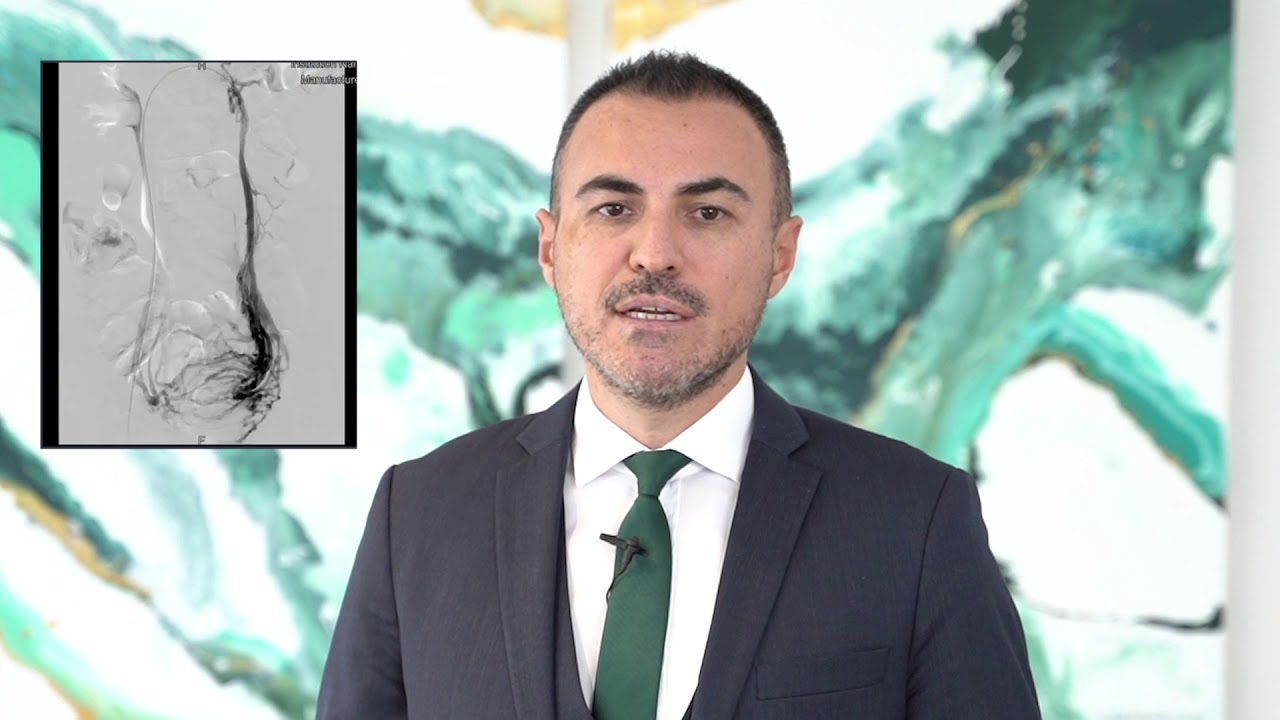 Pelvik Konjesyon Sendromu (Rahim varislerinin) tedavisi nasıl yapılır? #pelvikkonjesyonsendromu