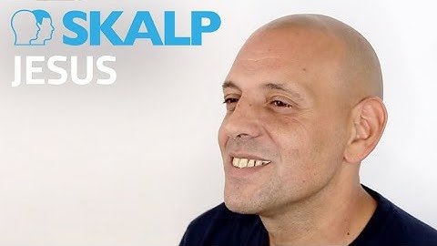 Jesus talks about his scalp micro pigmentation treatment at Skalp®