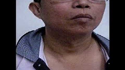 MRCP PACES Cardiology Station