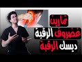تمارين علاج ألم غضروف الرقبة انزلاق غضروف الرقبة Cervical Disc 