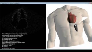 How to get the standard transthoracic echocardiography (TTE) views