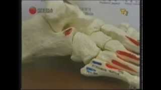 Icable TV - 物理治療之拗柴處理方法(2006年8月)