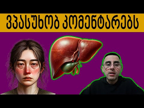 რატომ აჭრიან ნაღვლის ბუშტს ასე ხშირად ხომ საჭიროა? ვპასუხობ კომენტარებს