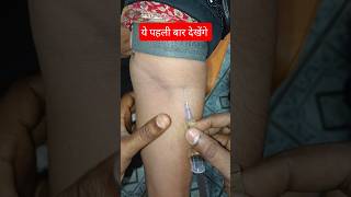 Intravenus injection Technique ⚕️#trendingshorts #viral #ivinjection #video #doctorlife #helthcare