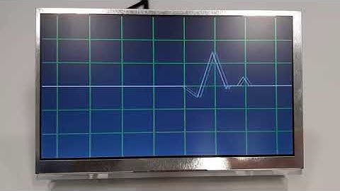 FPGA LCD animation: Cardiogram