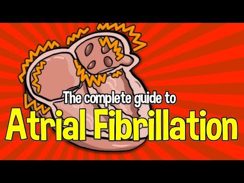 Video: Atrial Fibrillation - Symptoms, Treatment, Diet, Causes, Signs